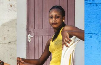 Stop Using Bleaching Cream Today? Here Is What Will Happen to Your Skin