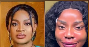 Uche Ogbodo Shows Off Dramatic New Look After Cosmetic Procedure