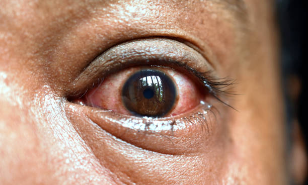 The human Eye of a sadness or panic stricken or scared