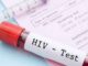 Experts Reveals 4 Reasons Why Some People Show Strong Resistance to HIV Infection