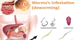 5 Signs Your Body Shows That It Needs To Deworm