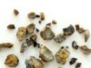 7 Natural Ways to Help Prevent Kidney Stones and Protect Your Kidneys