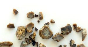 7 Natural Ways to Help Prevent Kidney Stones and Protect Your Kidneys