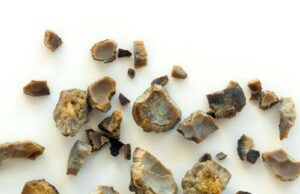 7 Natural Ways to Help Prevent Kidney Stones and Protect Your Kidneys