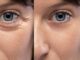 How to Reduce Wrinkles Under Your Eyes and Keep Your Skin Looking Younger