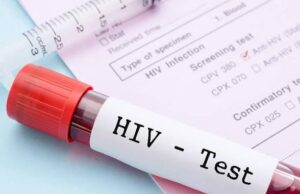 HIV Positive But Not Sick? 3 Reasons Some People Can Have HIV for Years Without Symptoms