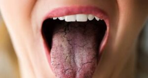 10 Warning Signs Your Body May Be Telling You to Drink More Water